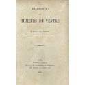 Diagnostic des tumeurs du ventre